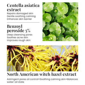 KORMESIC Private Label OEM 5% Benzoyl Peroxide Acne Removing Face Body Skin Care Set Rejuvenating Gel Korean Skin Care Products - Product Image 4