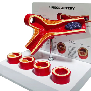 Anatomía humana 4 etapas Arteria y vasos sanguíneos <span class=keywords><strong>Medicina</strong></span> Patología trombo modelo - Product Image 3