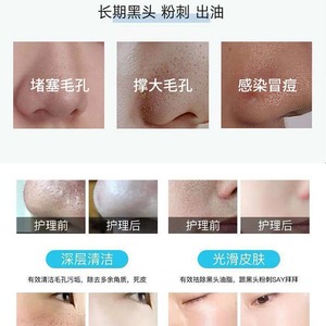 Microbubble Beauty Device With Skin Analysis And Hydration Function For Commercial Use With Ipad Control And Bluetooth - Product Image 3