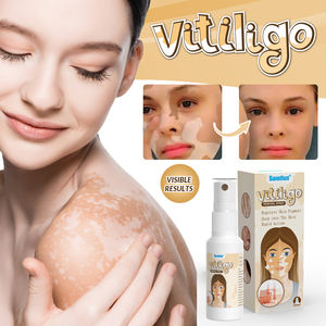 Sumifun New White Spot Remove Spray Herbal Vitiligo Repair Vitiligo Treatment Spray 30ml - Product Image 4
