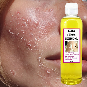 Huile Exfoliante Correctrice Vergetures Cicatrices Taches Brunes Éclaircissante Réparatrice Camélia Camomille Réglisse 110ml - Product Image 2