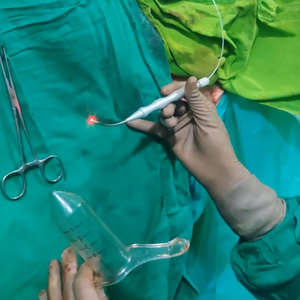 Proctology Laser phẫu thuật 1470 NM 980nm proctology Diode Laser hemorroide LỖ RÒ máy - Product Image 5