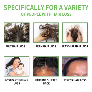 <strong>Supplier</strong> Wholesale Organic Argan <strong>Oil</strong> <strong>of</strong> Morocco for Hydrating Hair Serum Repair Damaged Hair Growth <strong>Oil</strong> for Nourishes <strong>Scalp</strong> - Product Image 4