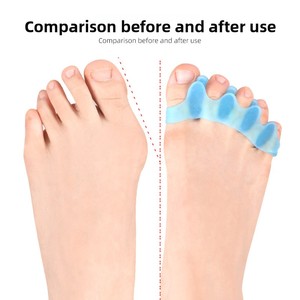 Gel silikon, Gel silikon pemisah jari tumpang tindih, korektor Hallux Valgus untuk menghilangkan rasa sakit Pria Wanita anak-anak - Product Image 2