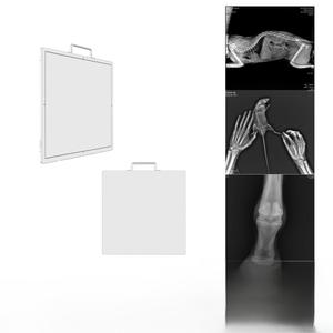 Detector de Rayos X de Panel Plano, Panel de Radiografía Digital DR, Fabricante de Detectores de Rayos X Médicos, Precio OEM ODM - Product Image 2