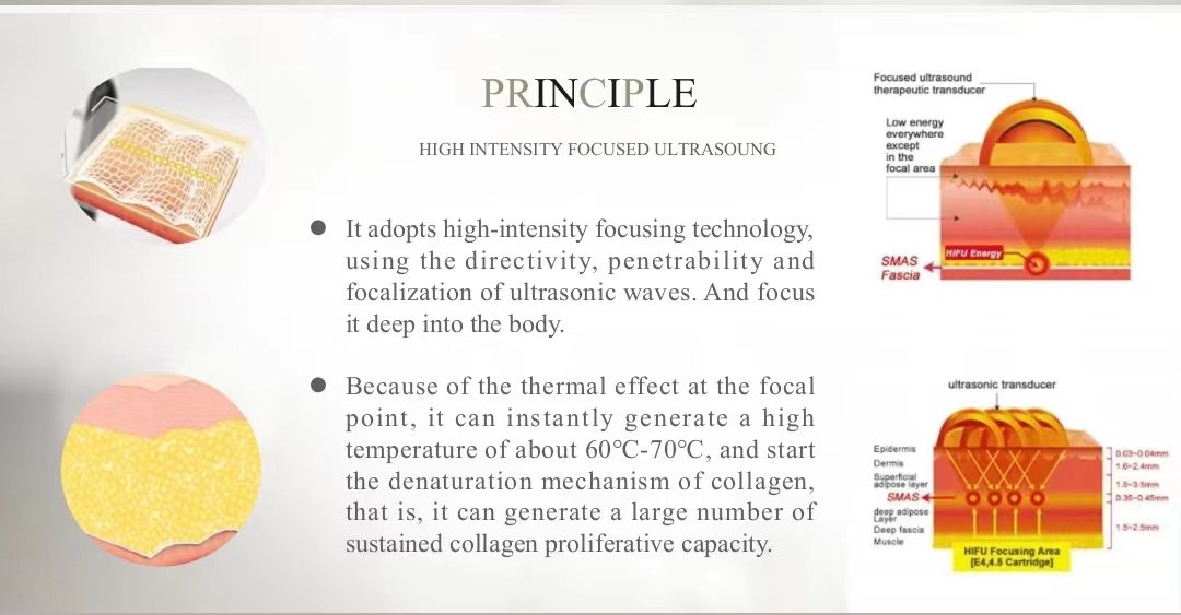 2023 New 8D HIFU Ultrasound Skin Tightening Machine Hifu Therapy For Face And Neck Lifting