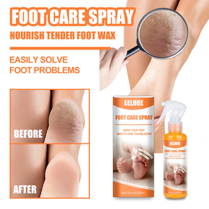 Private Label Deep Cleansing Smooth Skincare Peeling Foot Skin Care Gel Orange <b>Oil</b> Foot Peeling <b>Spray</b> Organic Remove Dead Skin - Product Image 3