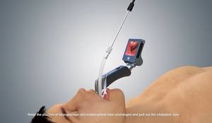 <span class=keywords><strong>Kit</strong></span> vidéo de laryngoscope réutilisable HYHJ-KC tenu dans la main avec 6 lames pour l'<span class=keywords><strong>intubation</strong></span> pédiatrique et adulte - Product Image 2