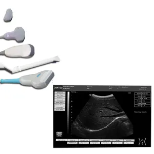 Draagbare Ultrasone, Diagnostische Doppler-Echografieapparatuur