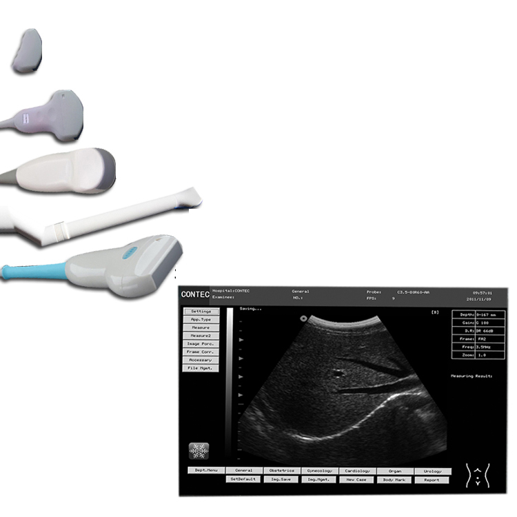 Contecmed Portable Ultrasound China Portable Ultrasonic