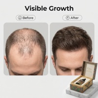 Serum Minyak Penumbuh Rambut OEM ODM Label Pribadi 30ml Formula Khusus Perawatan Minyak Jarak Grosir Pabrik Langsung MOQ Rendah FITN