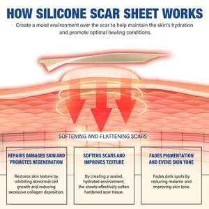 Láminas de Silicona para Cicatrices, Grado Médico, para Cirugía, Cesárea, Queloides, Quemaduras, Tiras Reutilizables para Eliminar Cicatrices, Cortables a Medida - Product Image 4