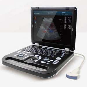 Ecógrafo Portátil Plegable con Múltiples Sondas <span class=keywords><strong>Doppler</strong></span> Médicas para Hospitales, Clínicas Veterinarias y Granjas Ganaderas, Pedidos al por Mayor - Product Image 1