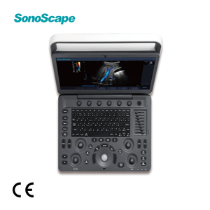 เครื่องสแกนอัลตร้าซาวด์ sonoscape E2V สีพกพาสำหรับสัตวแพทย์ใช้ในโรงพยาบาลคลินิกสัตว์ - Product Image 1