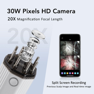 Masajeador Eléctrico para la Cabeza - Product Image 2