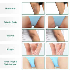 Crème éclaircissante pour le corps <span class=keywords><strong>et</strong></span> les zones intimes, étiquette privée OEM, crème blanchissante correctrice des taches brunes - Product Image 5