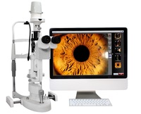 Solución de Imagenología Avanzada para Lámpara de Hendidura Phoenix de Fabricante Directo para Diagnóstico Ocular Portátil