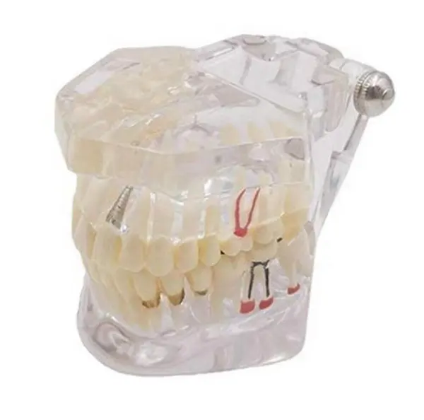 نموذج للأسنان شفاف لتدريس الأسنان بالعلوم الطبية, نموذج للأسنان الطبية والمرضة