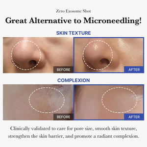 Suero de Niacinamida Coreano Zero Pore One Day AHA BHA, Suero Blanqueador Minimizador de Poros - Product Image 5