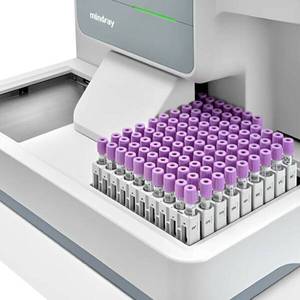 Analyseur d'hématologie automatique Mindray BC-6800 Plus, équipement de diagnostic laboratoire pour animaux, analyse de sang complète (CBC) pour hôpitaux et cliniques - Product Image 4