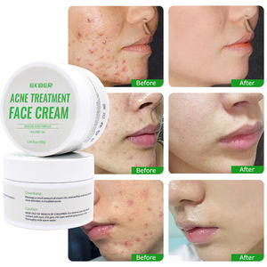 プライベートラベルアンチエイジングクリームリンクルアクネビタミンモイスチャライザーアロエフェイススキンホワイトニングアンチアクネクリーム - Product Image 2