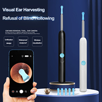 AI Slimme Oorwasverwijderaar Ultra HD Camera WiFi 2.4GHz 20fps Trommelvlak Automatische Detectie 6 LED Lampjes 3.5mm Lens IP55 Waterdicht