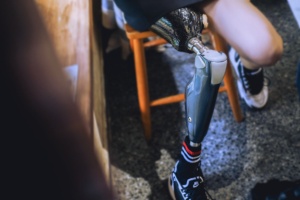 Kulit serat karbon palsu cerdas, prostesis lutut dengan dukungan jalan adaptif banyak Medan - Product Image 3