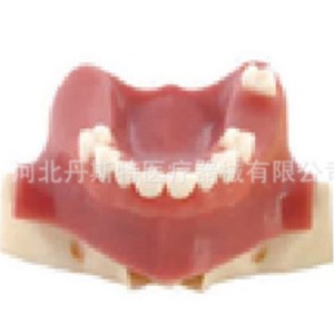 Modèle dentaire Dt M2013S en résine, modèle anatomique pour l'enseignement des sciences médicales - Product Image 1