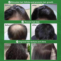 30ml 100% Minyak Esensial Rosemary Murni untuk Pertumbuhan Rambut Anti-Rontok Minyak Pijat Kulit Kepala Label Pribadi Wanita Pria Grosir