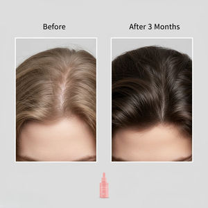 プライベートブランドの新しい有機ビーガンビオチンアルガンオイル育毛防風強化肥厚頭皮ケア2-IN-1 - Product Image 3