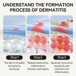 <span class=keywords><strong>Crema</strong></span> <span class=keywords><strong>para</strong></span> el Cuidado de la <span class=keywords><strong>Dermatitis</strong></span> Seborreica con Hierbas Naturales, Humectante Reparador Facial Calmante <span class=keywords><strong>para</strong></span> Cuero Cabelludo Graso - Product Image 3