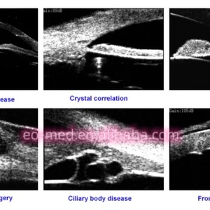 UBM3200S Biomicroscope à ultrasons portable de haute qualité à prix abordable pour ophtalmologie, échelle complète UBM 50/35 MHz - Product Image 6