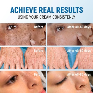 Crema Aclarante para Manchas Oscuras con Perla y Vitamina C para el Rostro - Crema Aclarante para la Piel para Mujeres y Hombres - <span class=keywords><strong>Corrector</strong></span> <span class=keywords><strong>de</strong></span> Manchas Oscuras - Crema Iluminadora - Product Image 5