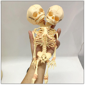 Modelo de Esqueleto Humano de Bebé para Ciencias Médicas, Esqueleto de Feto de Doble Cabeza, Modelo de Cráneo con Deformidad, Recurso Experimental - Product Image 2