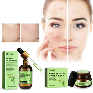 Kit de cuidado facial Reparación de hierbas Suero facial Nutrir Control de aceite Suero antiacné Conjunto de crema para el cuidado de la piel - Product Image 2