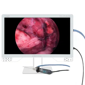 TUYOU yüksek değerli HD tıbbi endoskopi ekipmanları cerrahi endoskop kamera