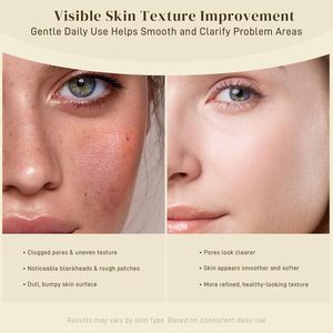 Oem ODM nhãn hiệu riêng Sữa rửa mặt làm sạch sâu chống Ance sáng Kojic axit và nghệ miếng làm sạch - Product Image 6