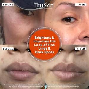 Per TruSkin Anti-invecchiamento siero viso 1 FlOz Formula illuminante vitamina C acido ialuronico vitamina E bersaglia macchie scure linee sottili - Product Image 4