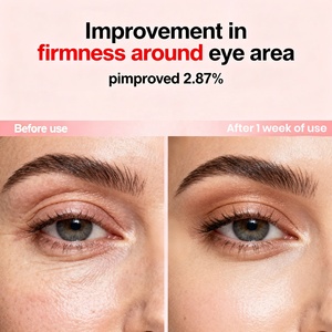 Pdrn Hồng Peptide Huyết thanh mắt chống lão hóa nếp nhăn loại bỏ quầng thâm túi mắt dưới mắt huyết thanh - Product Image 3