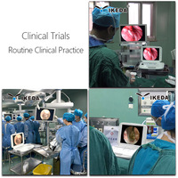 Système de caméra endoscopique nasale électrique portable IKEDA YKD-9003 avec moniteur pour imagerie chirurgicale laparoscopique, usage hospitalier, CE Classe I