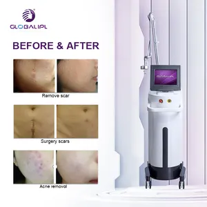 Skin Resurfacingเลเซอร์Erbium Fractional Co2ทางการแพทย์เลเซอร์