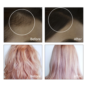 Nhãn Hiệu Riêng Bán Hàng Nóng Tự Nhiên Hữu Cơ Người Đàn Ông Phụ Nữ Nuôi Dưỡng Da Đầu Tăng Cường Tóc Hương Thảo Tăng Trưởng Tóc Dầu - Product Image 2