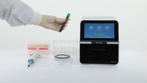 Analizador de Química seca veterinaria para bioquímica, prueba de electrolitos, pruebas de bioquímica, prueba de 32 pruebas - Product Image 5