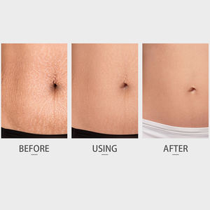 Huile anti-vergetures Femme enceinte Grossesse Maternité Corps Huile anti-vergetures - Product Image 3