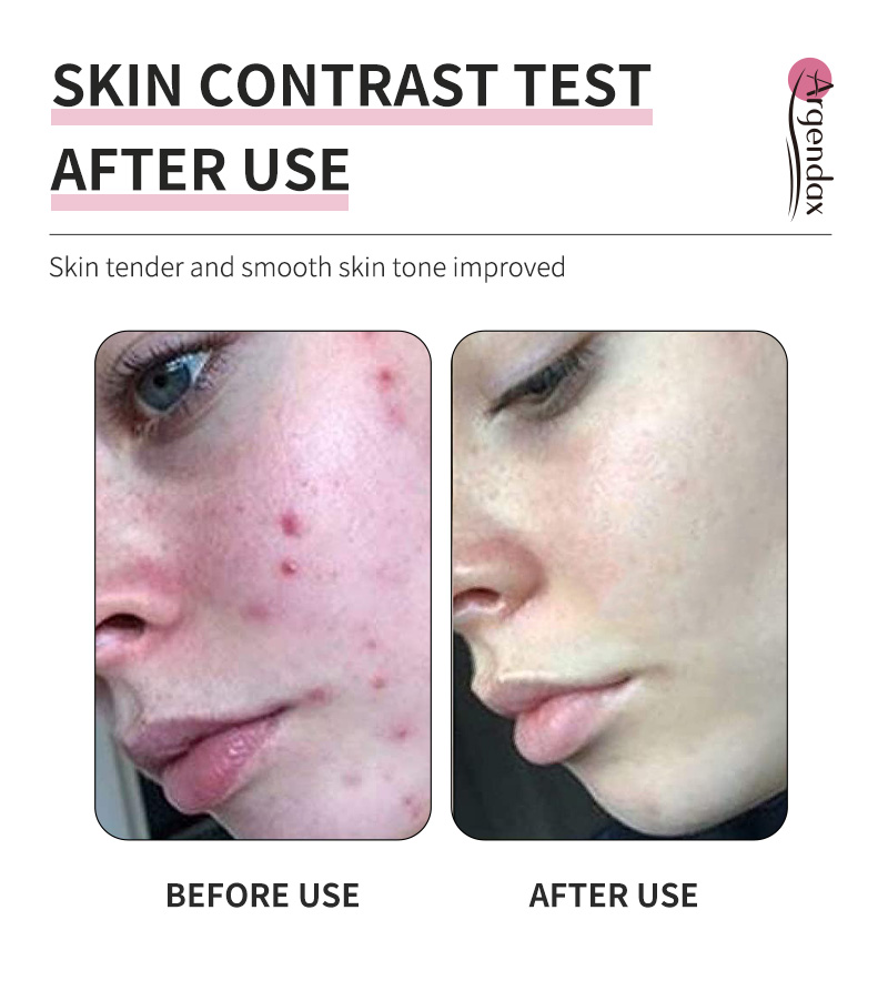 Private LABEL OEM organic purifying Skin Care Lightening brightening pink clay mud mask