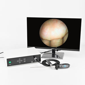 Equipo de cámara de endoscopio Full HD digital 1080P médico, sistema de vídeo de endoscopia con cabezal de cámara FHD - Product Image 1