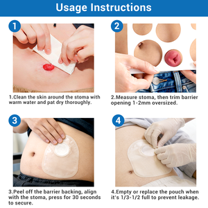 <span class=keywords><strong>Bolsa</strong></span> de Colostomía Drenable BLUENJOY, <span class=keywords><strong>Bolsa</strong></span> de Ileostomía, Barrera Cutánea <span class=keywords><strong>Convexa</strong></span>, Bolsas de Ostomía de 2 Piezas <span class=keywords><strong>para</strong></span> Adultos - Product Image 6