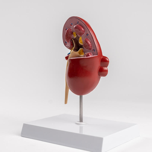 Modelo de Riñón Patológico, Modelo Anatómico Humano para Enseñanza Médica, Demostración de Nefritis, <span class=keywords><strong>Urología</strong></span> Renal, Hospital - Product Image 6