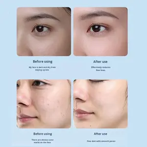 Stylo Meso ABS Portable Nano Microcristallin à Infusion USB pour Hydratation, <span class=keywords><strong>Appareil</strong></span> de Soin Facial à Domicile à Micro-aiguilles, Exosome, Étanche - Product Image 2