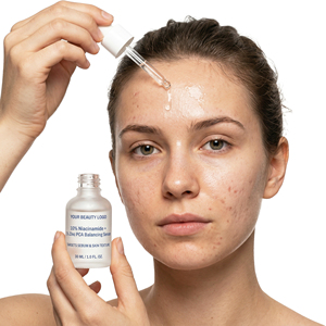 Exfoliant chimique doux BHA, tonique liquide avec <span class=keywords><strong>2</strong></span> % d'<span class=keywords><strong>acide</strong></span> <span class=keywords><strong>salicylique</strong></span> pour les pores dilatés, formule personnalisée - Product Image 6